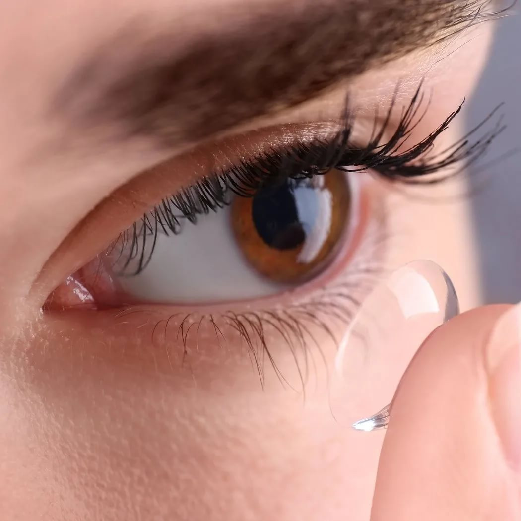 Prodazha-kontaktnyh-linz